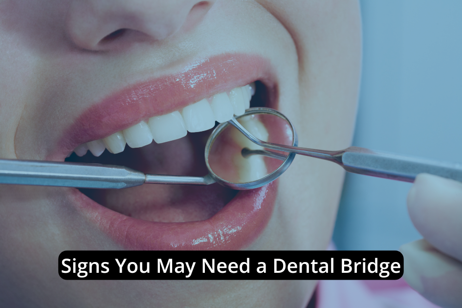A close-up of a dentist examining a patient's teeth with dental tools, accompanied by the text "Dental Bridge Signs: Signs You May Need a Dental Bridge.