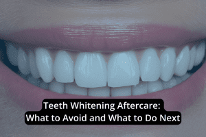 Close-up of a smiling mouth with white teeth, overlaid with text: "Teeth Whitening Aftercare: What to Avoid and What to Do Next"—essential tips for effective teeth whitening aftercare.
