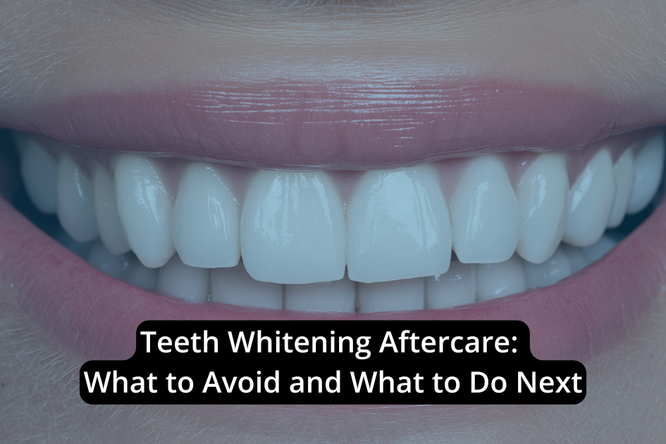 Close-up of a smiling mouth with white teeth, overlaid with text: "Teeth Whitening Aftercare: What to Avoid and What to Do Next"—essential tips for effective teeth whitening aftercare.